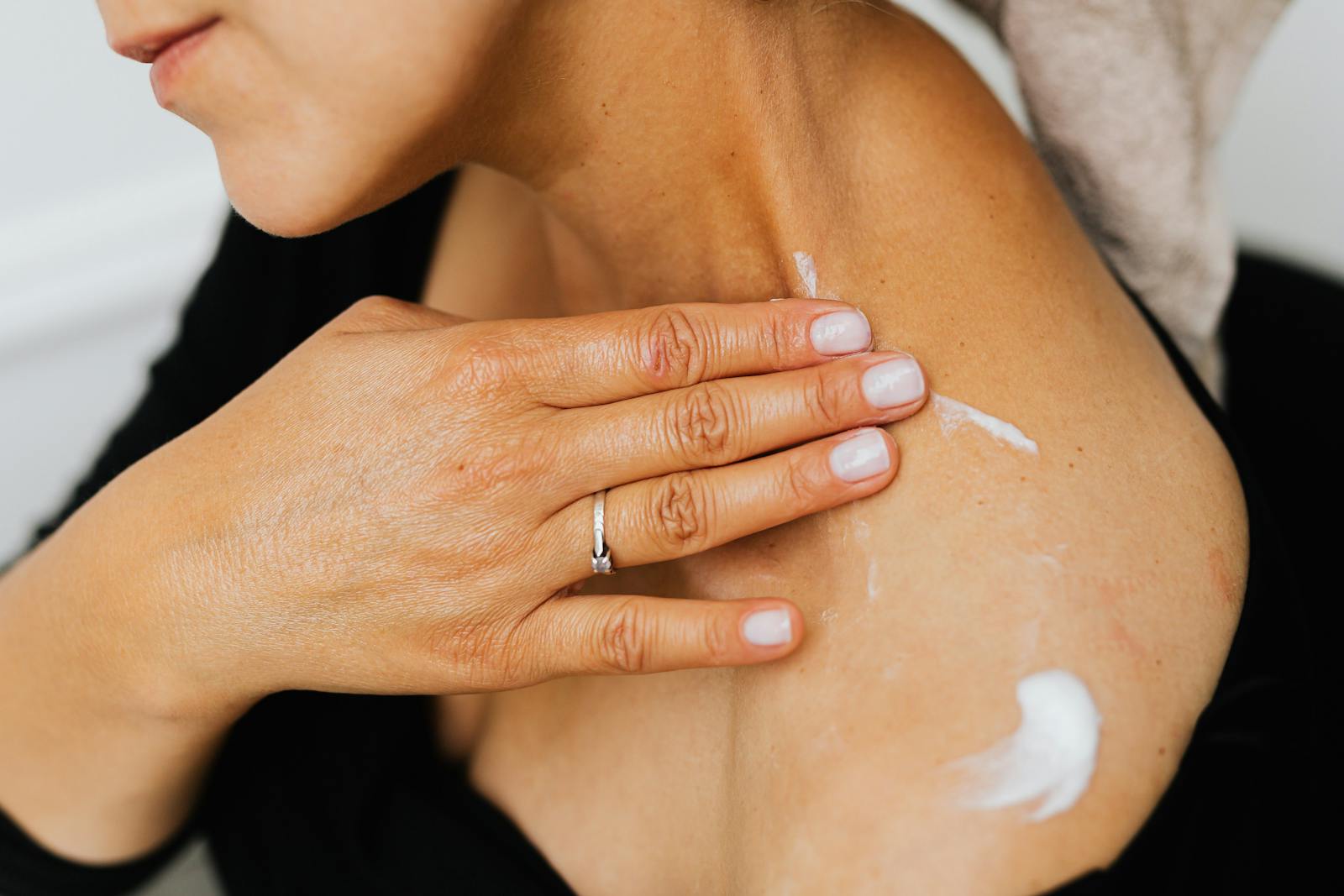 Lotion